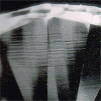 鑽石內含物,鑽石雜質,鑽石淨度,內部雙晶紋,internal graining